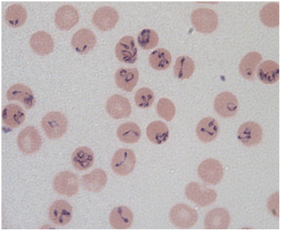 photo des globules rouges infecté par le parasite de la babesia