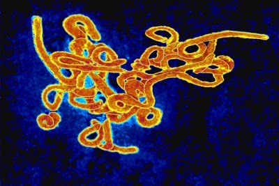 Photo du virus de l'Ebola
