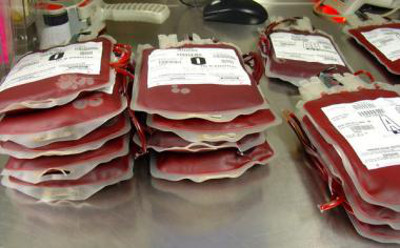 photo de produits sanguins labiles prêts à être transfusés