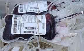 Photo de produits sanguins labiles avant prÃ©paration