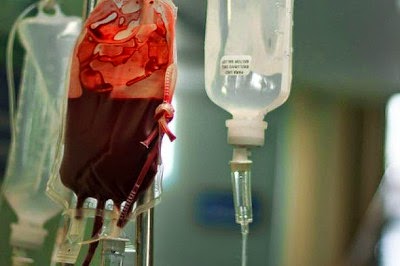 Photo d'une transfusion sanguine